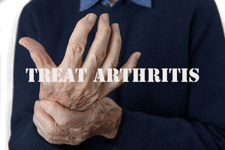 Arthritis Marijuana Strain